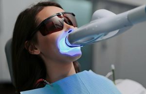 Современное отбеливание зубов: эффективные методики в стоматологии